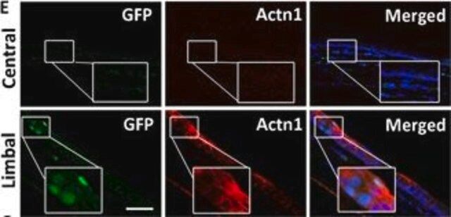 Anti-ACTN1 antibody produced in rabbit