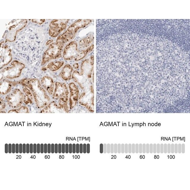 Anti-AGMAT antibody produced in rabbit