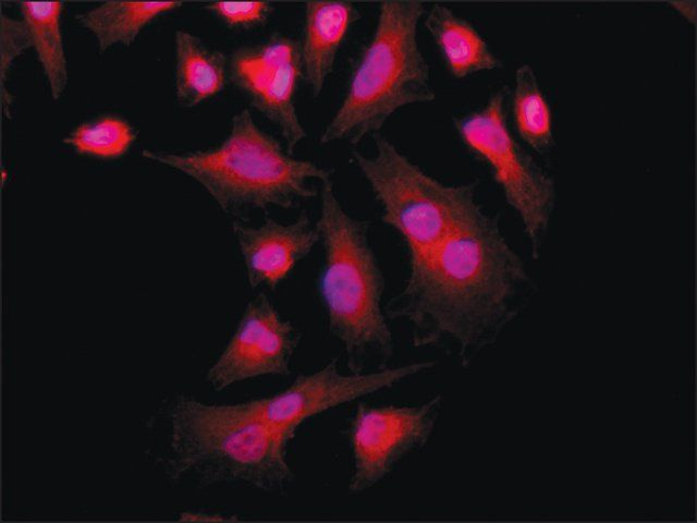 Anti-PKM2 (C-terminal) antibody produced in rabbit