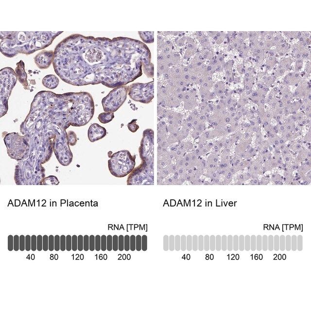 Anti-ADAM12 antibody produced in rabbit