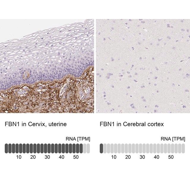 Anti-FBN1 antibody produced in rabbit