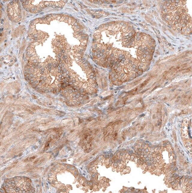 ANTI-FAT1 antibody produced in rabbit