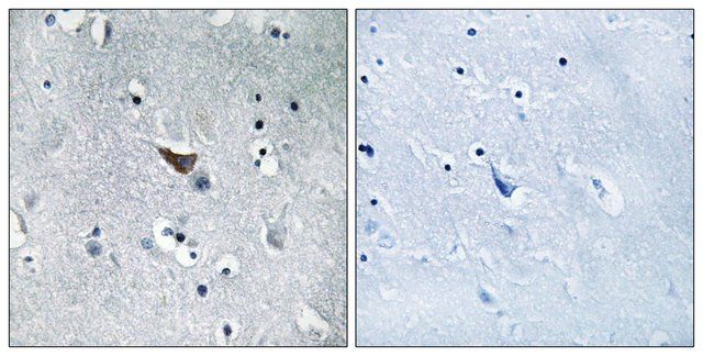 Anti-GLUR1 antibody produced in rabbit