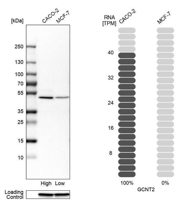 Anti-GCNT2 antibody produced in rabbit