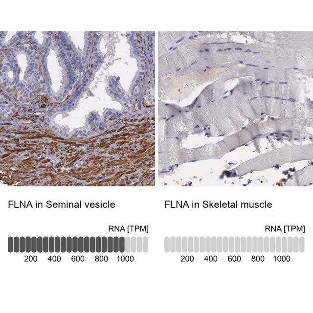 Anti-FLNA antibody produced in rabbit