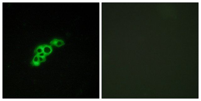 Anti-FSHR antibody produced in rabbit