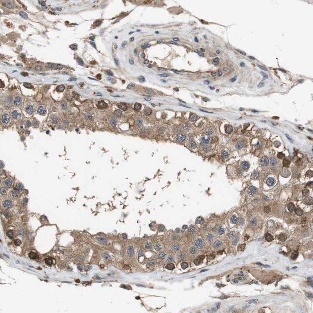 Anti-FZD10 antibody produced in rabbit