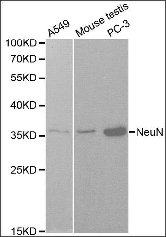 Anti-NeuN antibody produced in rabbit