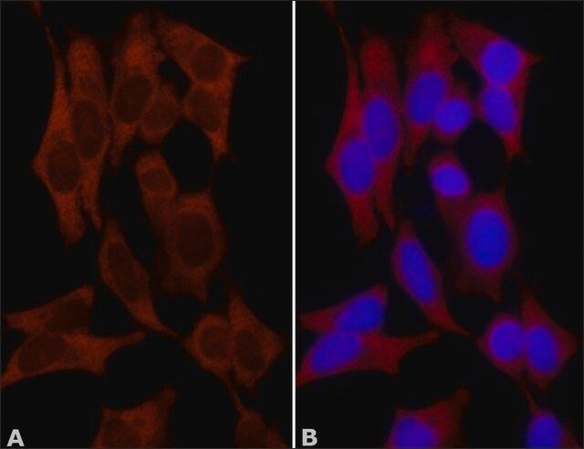 Anti-NQO1 (C-terminal) antibody produced in rabbit