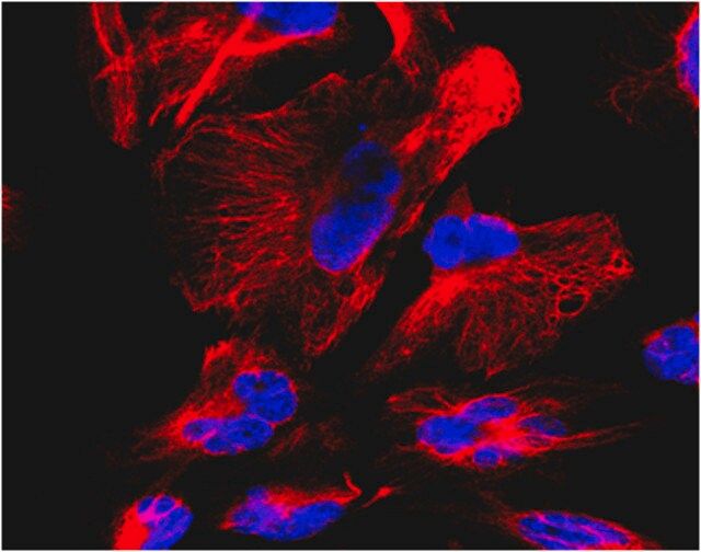 Anti-Nestin, Human Antibody