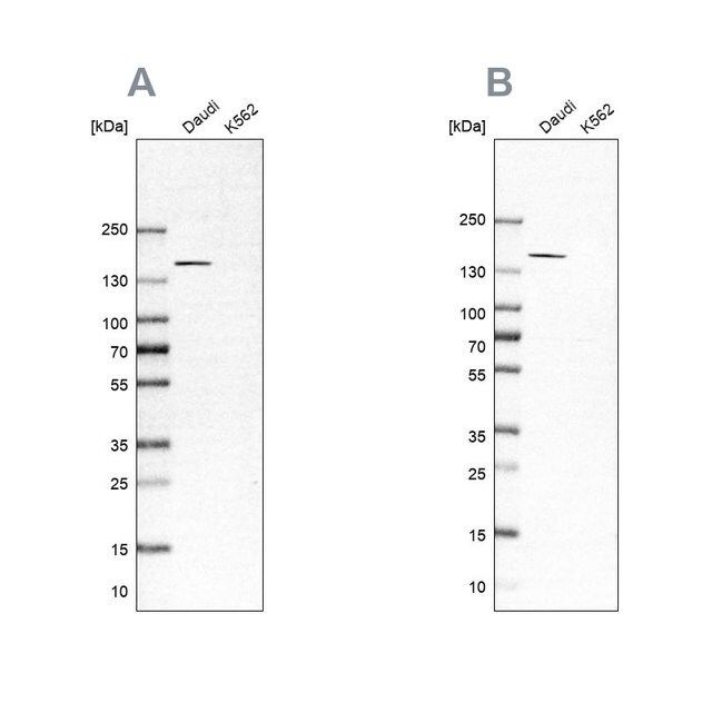 Anti-PLCG2 antibody produced in rabbit