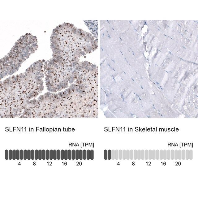 Anti-SLFN11 antibody produced in rabbit