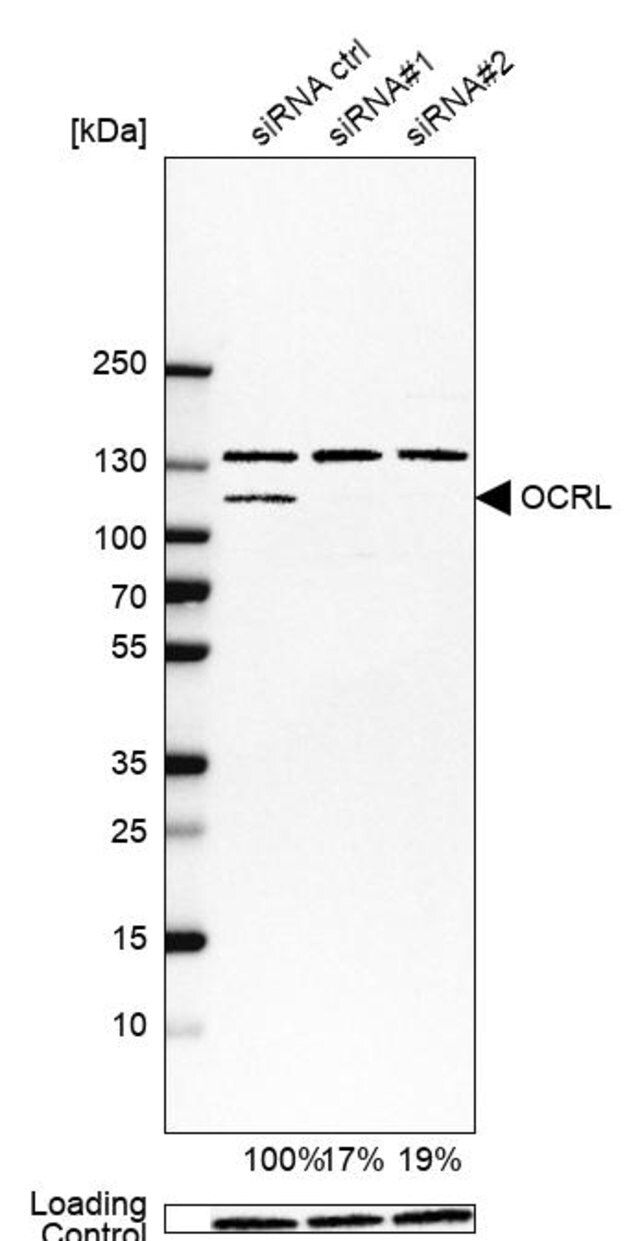 Anti-OCRL antibody produced in rabbit