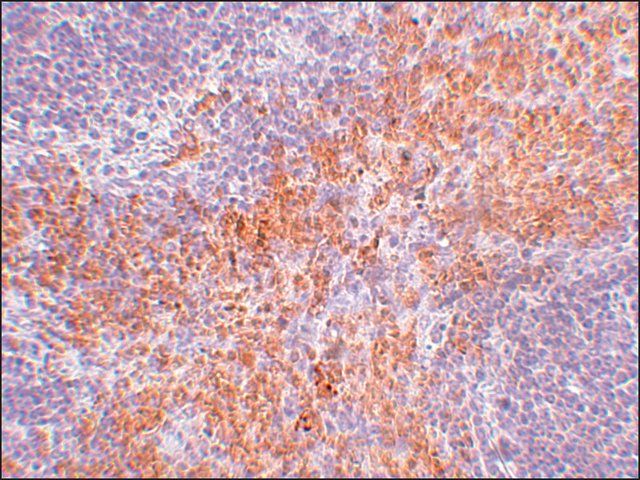 Anti-RIPK1 antibody produced in rabbit