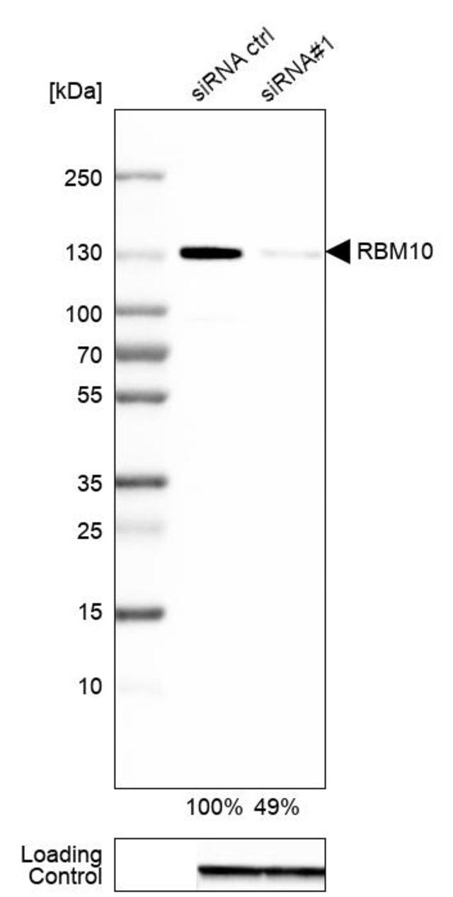 Anti-RBM10 antibody produced in rabbit