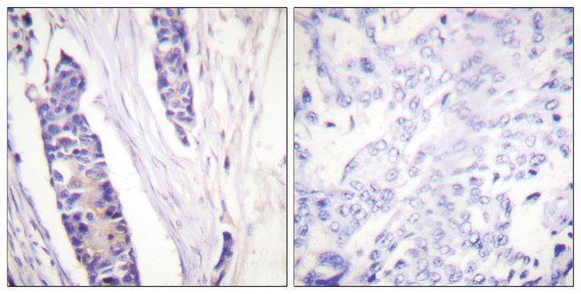 Anti-Tubulin  antibody produced in rabbit