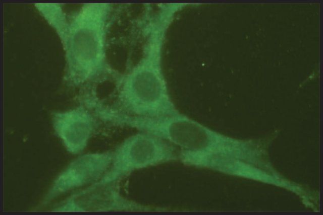 Anti-Rab7 antibody produced in rabbit