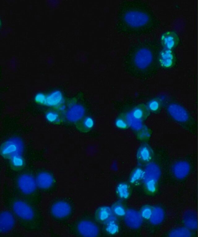 Anti-phospho-Histone H3 (pSer<sup>10</sup>) antibody produced in rabbit