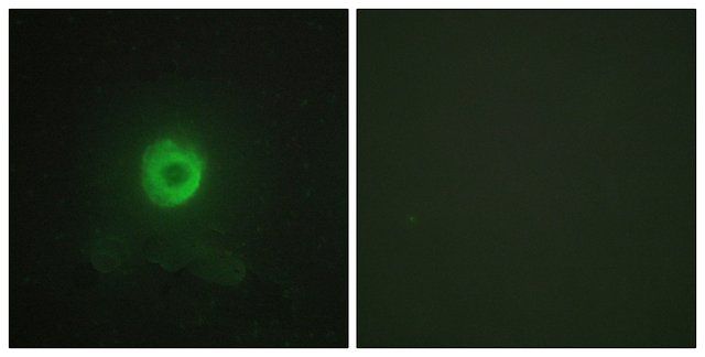 Anti-TNF Receptor II, antibody produced in rabbit