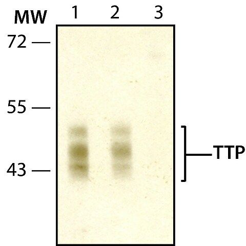 Anti-TTP (N-terminal) antibody produced in rabbit