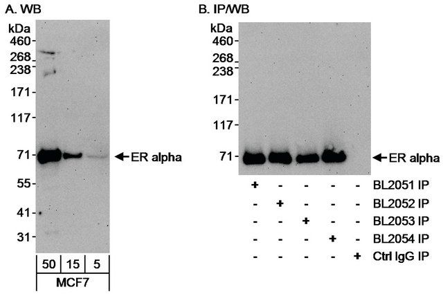 Rabbit anti-Estrogen Receptor Alpha Antibody, Affinity Purified