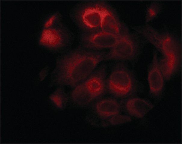 Anti-STIM1 (C-terminal) antibody produced in rabbit