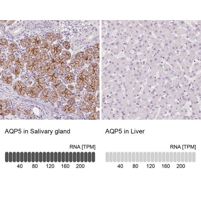 Anti-AQP5 antibody produced in rabbit