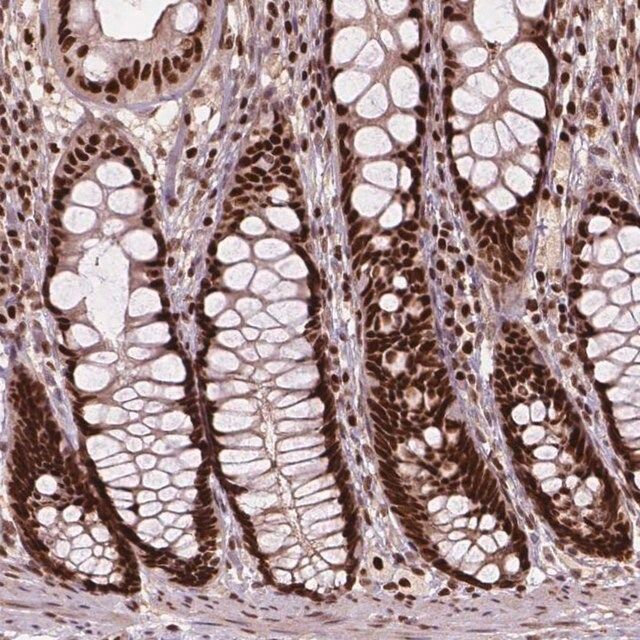 Anti-ANP32A antibody produced in rabbit