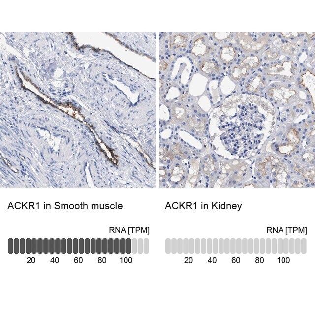 Anti-ACKR1 antibody produced in rabbit