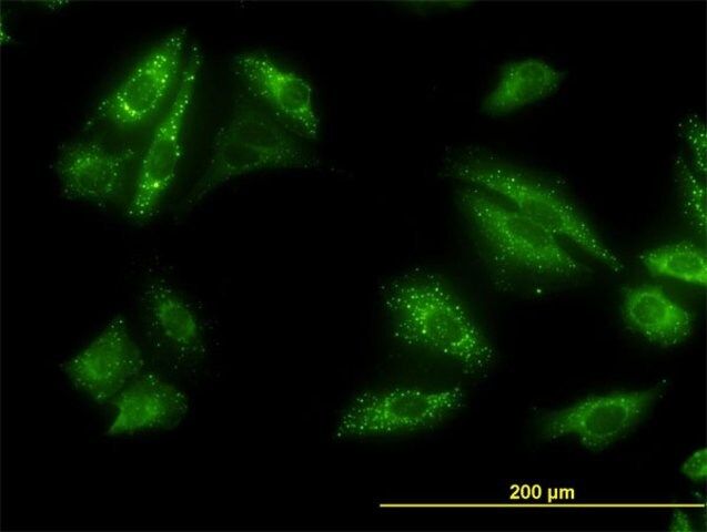 Monoclonal Anti-SQSTM1 antibody produced in mouse