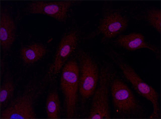 Anti-ARPC4 (26-40) antibody produced in rabbit