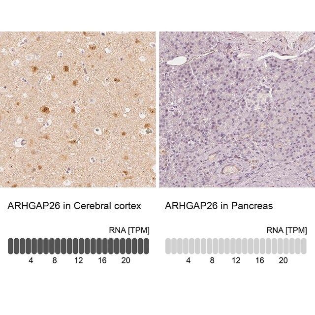 Anti-ARHGAP26 antibody produced in rabbit