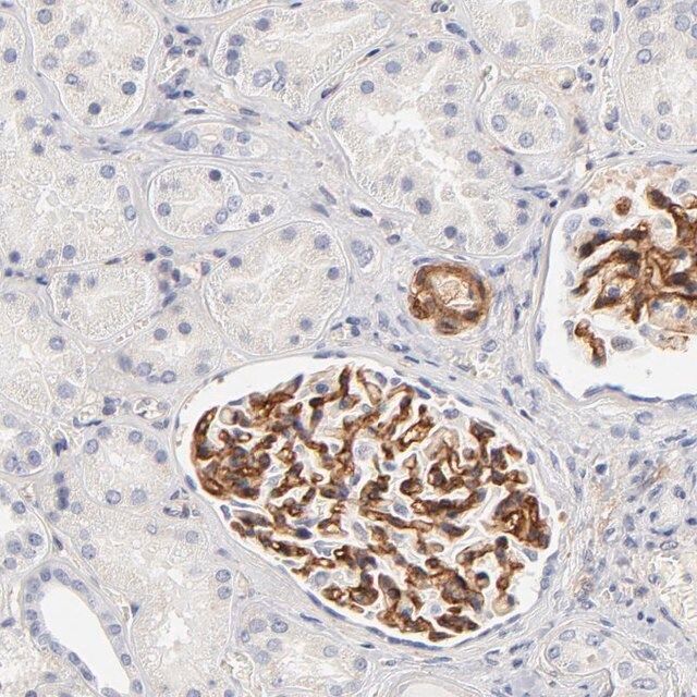 Anti-ITGA8 antibody produced in rabbit