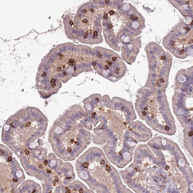 Anti-ITGAE antibody produced in rabbit