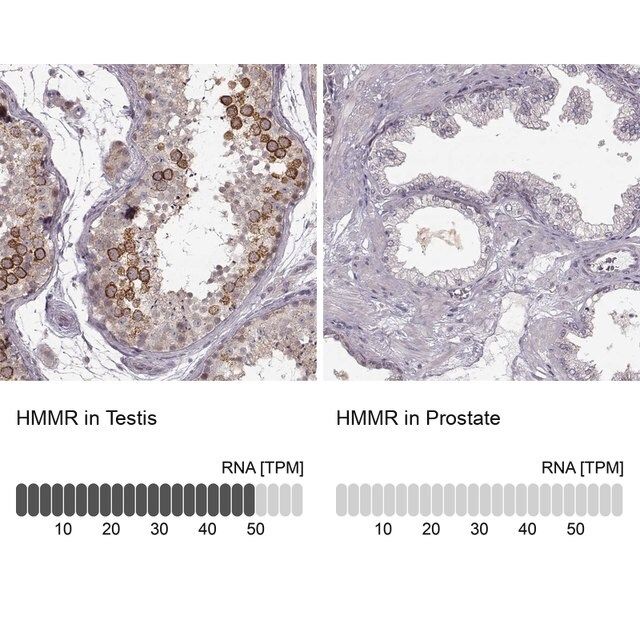 Anti-HMMR antibody produced in rabbit