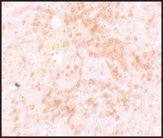 Anti-HVCN1 antibody produced in rabbit