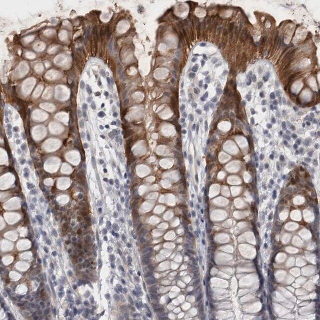 Anti-IFI44 antibody produced in rabbit