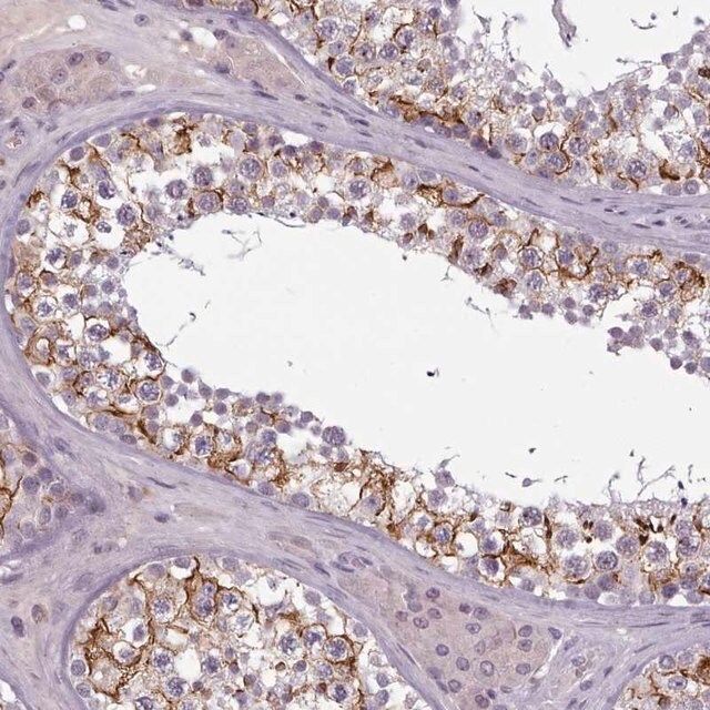 Anti-PBX4 antibody produced in rabbit