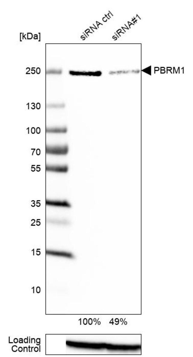 Anti-PBRM1 antibody produced in rabbit