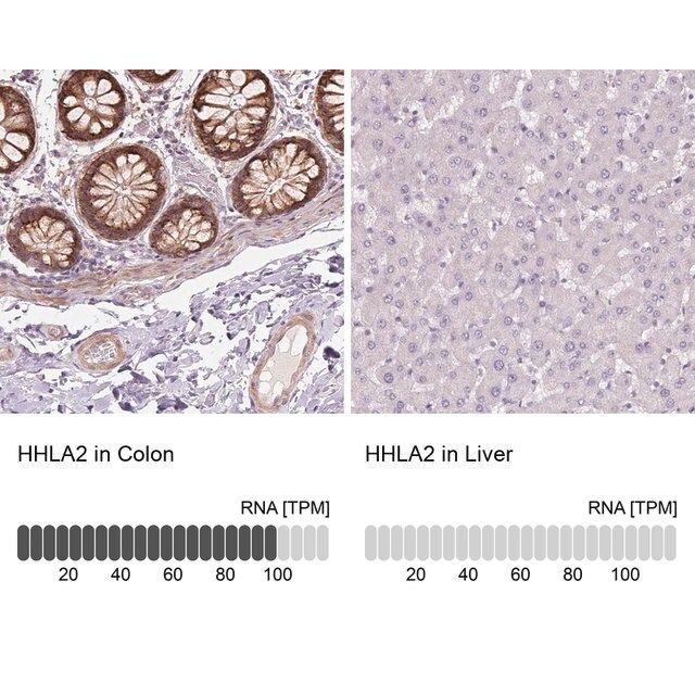 Anti-HHLA2 antibody produced in rabbit