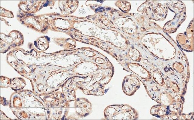 Anti-CD274/PD-L1 antibody produced in goat