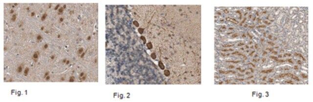 Anti-HES-1 Antibody