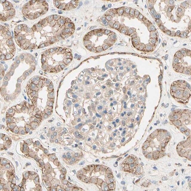 Anti-CDH6 antibody produced in rabbit