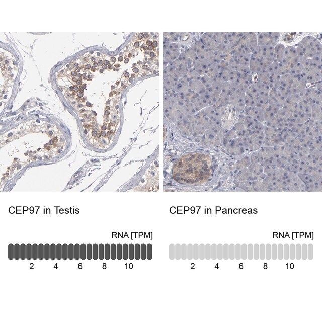 Anti-CEP97 antibody produced in rabbit