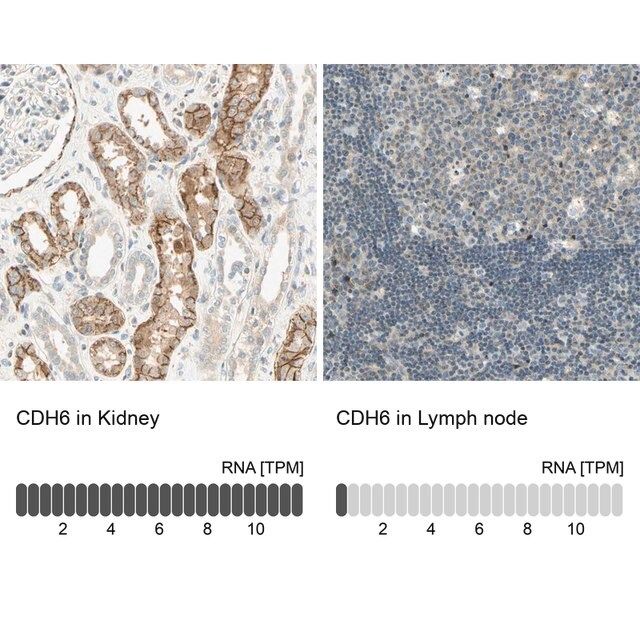 Anti-CDH6 antibody produced in rabbit