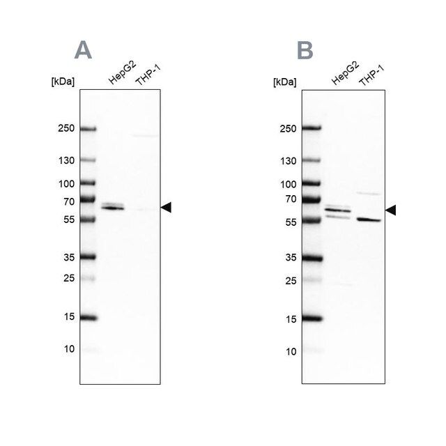 Anti-CDR2 antibody produced in rabbit