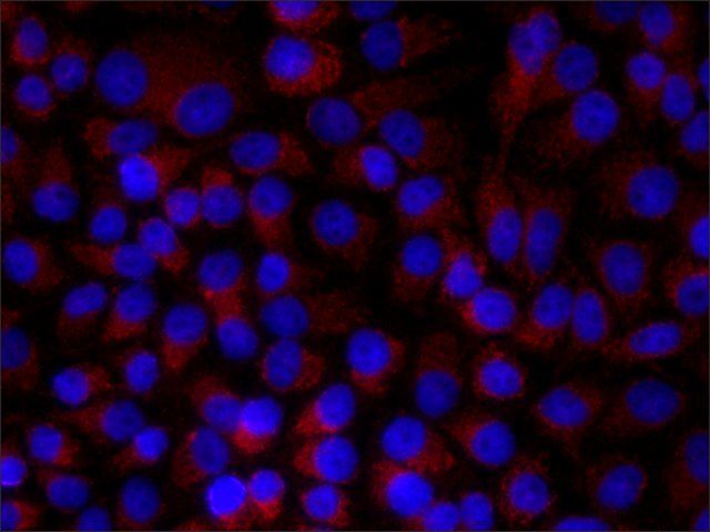 Monoclonal Anti-Paxillin antibody produced in mouse