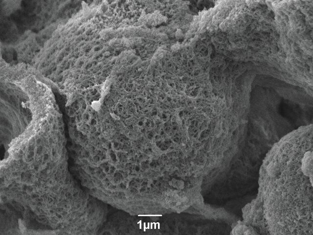 Carbon, mesoporous