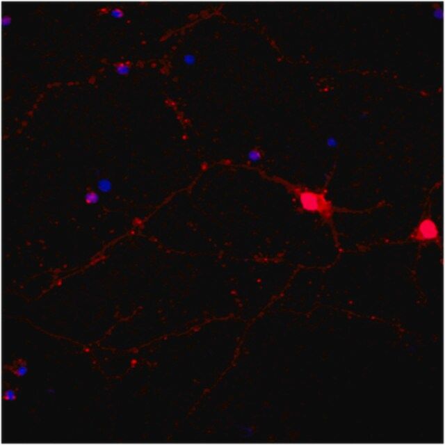 Anti-Neurofilament 200kDa Antibody, clone NE14, Alexa Fluor<sup>®</sup> 555 Conjugate