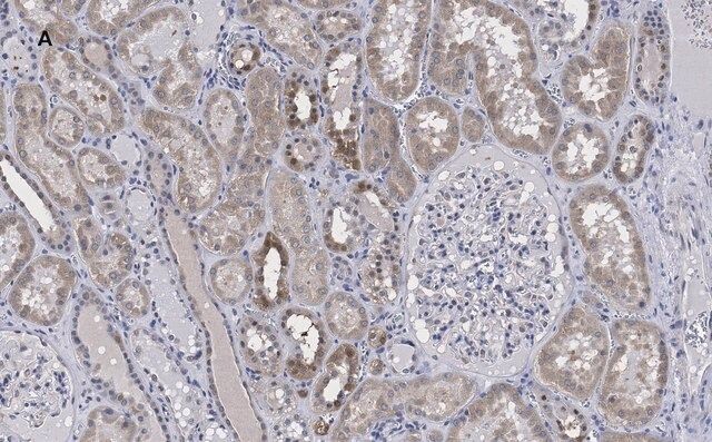 Anti-FADD Antibody, clone 11N7, ZooMAb<sup>®</sup> Rabbit Monoclonal